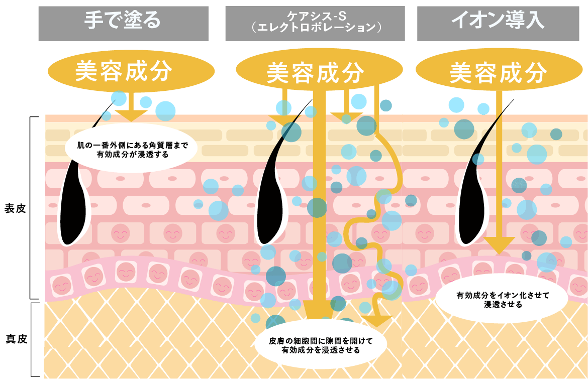 ガイアイオン SAJ・ホルミシス療法 医療法人双成会 島村京子クリニック | ケアシス-Sのご案内のご案内