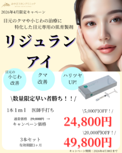 ４月限定プラン